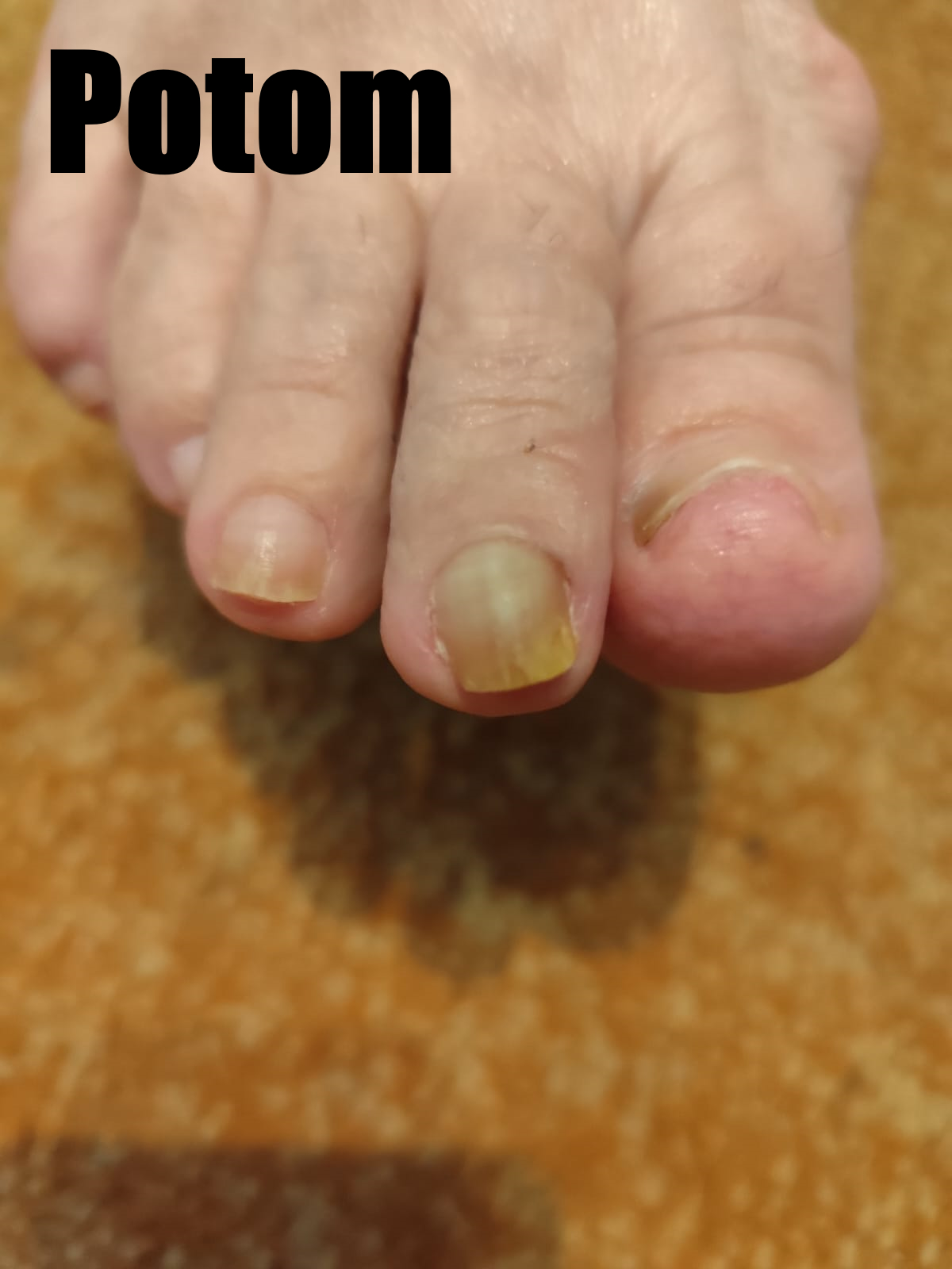Před